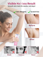 Skin Epilator, 2025 New Hair Remover for Women with LED Light, Portable Epilator, Epilator for Face/Arm/Pubic/Leg/Body/Finger/Bikini Area Electric Hair Remover