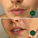 Nad'S Facial Wax Strips - Facial Hair Removal for Women - Waxing Kit with 48 Fac